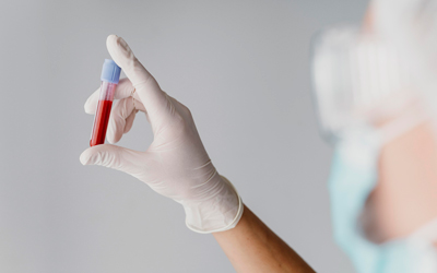 Анализы на наркотики - Квинмед Анализы на наркотики - Квинмед